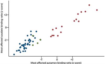 Bipolar Disorder and Parkinson's Disease: A 123I-Ioflupane Dopamine Transporter SPECT Study